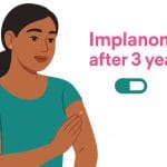 Illustration of a woman touching her upper arm at the implant site with the headline “Implanon after 3 years?”